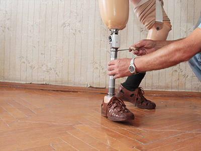 Prosthetics & Orthotics
